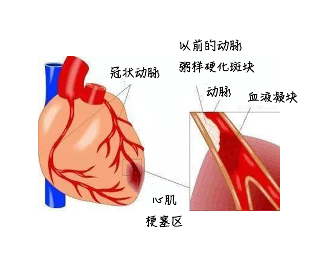 中医药健康旅游、心梗、面瘫