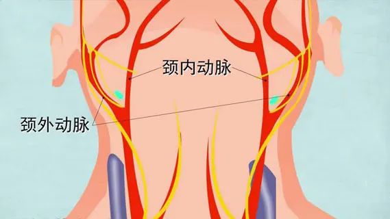 水蛭素、血管堵塞、粥样硬化